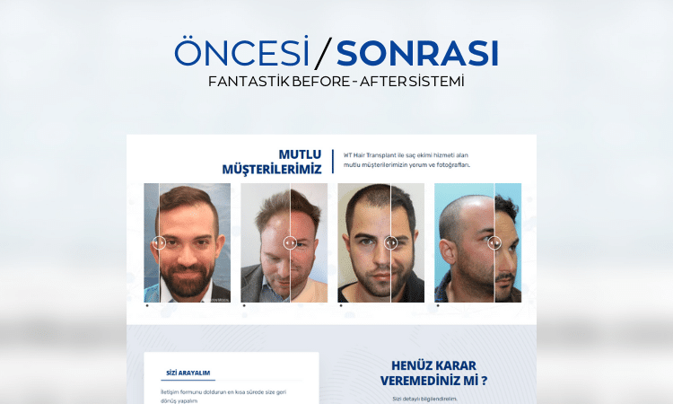 saç2